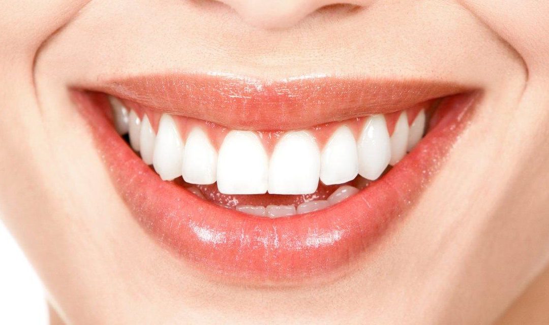 A FACETA DENTAL É PARA VOCÊ? DESCUBRA!