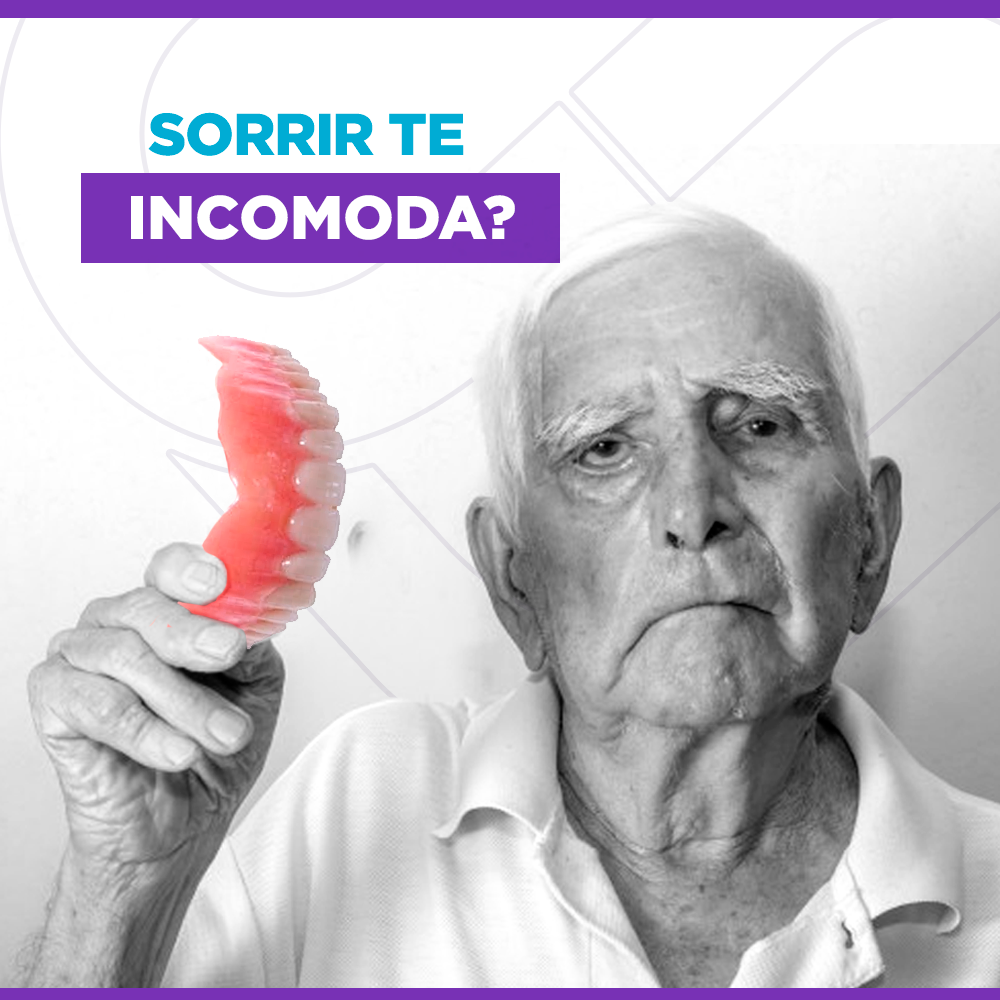 O QUE VOCÊ PRECISA SABER SOBRE OS TRATAMENTOS DE IMPLANTES DENTÁRIOS?