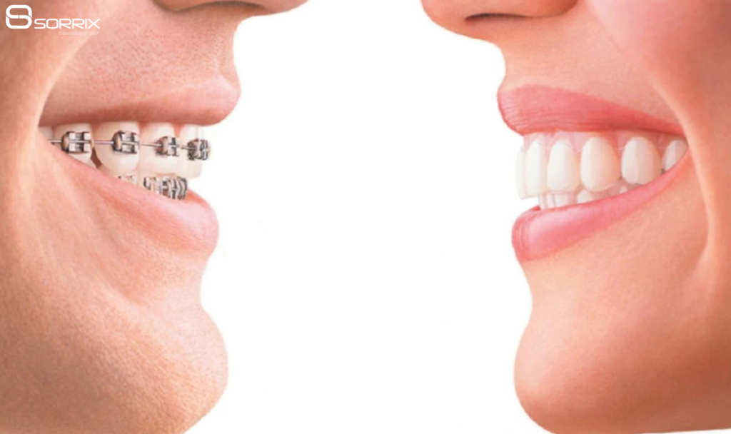 Ortodontia e Estética: como um sorriso alinhado pode transformar sua autoestima.